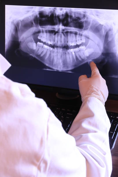 Best Broken or Cracked Tooth Emergency Dentist in Anderson Creek, NC